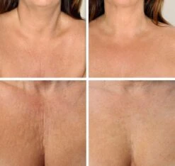 Simia™ Anti Rimpel Beauty Pads - Decolleté Large T Shape Set (2 Stuks) - Herbruikbaar Anti Aging Siliconen Pad Tegen Lijntjes En Slaaprimpels -Woonwinkel 1200x1139 9