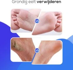 LifeWise Elektrische Eelt Verwijderaar - Voetvijl - 60 Vervangbare Schuurpads - Netstroom Adapter -Woonwinkel 1200x1155 12