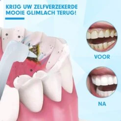 DEN-T® PRO P350 Elektrische Tandenpolijster - Wit - 5 Standen - 5 Opzetstukken - Polijstmachine - Polijstset - Tanden Polijsten - -Woonwinkel 1200x1200 2121