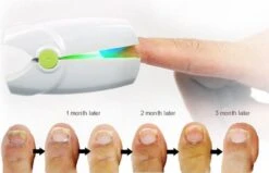 Anti Schimmelnagel Kalknagel Laserapparaat Om Zelf Te Behandelen, Veilig, Effectief, Snel En Pijnloos, Koude Laser Behandeling Voor Thuisgebruik, Voor Tenen En Vingers. Oplaadbaar. -Woonwinkel 1200x774 1